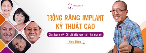 top-10-dia-chi-trong-rang-implant-uy-tin-nhat-tai-tphcm-6