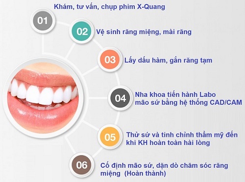 top-10-dia-chi-boc-rang-su-dep-uy-tin-nhat-tai-tphcm-6