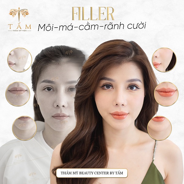 Top 10 địa chỉ tiêm Filler – Botox uy tín, an toàn nhất ở Hà Nội