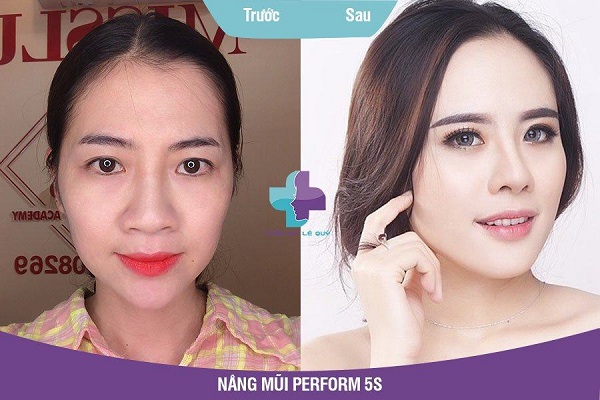 Top 8 địa chỉ nâng mũi đẹp và uy tín nhất tại Đà Nẵng