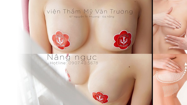 Top 5 địa chỉ nâng ngực đẹp và uy tín nhất tại Đà Nẵng