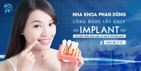 Top 10 địa chỉ trồng răng implant ở Đà Nẵng tốt nhất